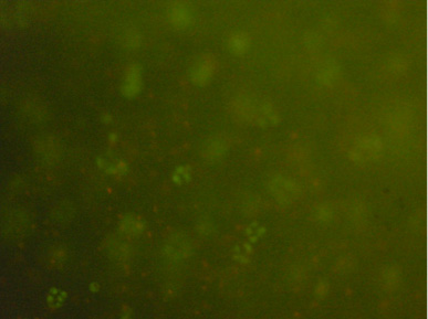 Photo of a few scattered bright green dots and one red dot on a very dark green background.